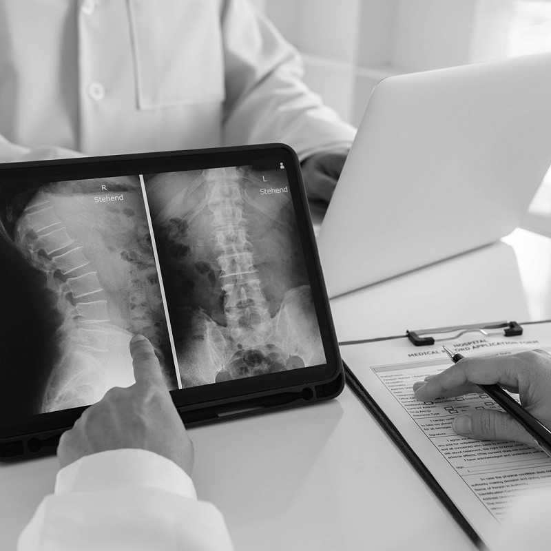 Medical professional pointing to an image of an x-ray on a tablet screen